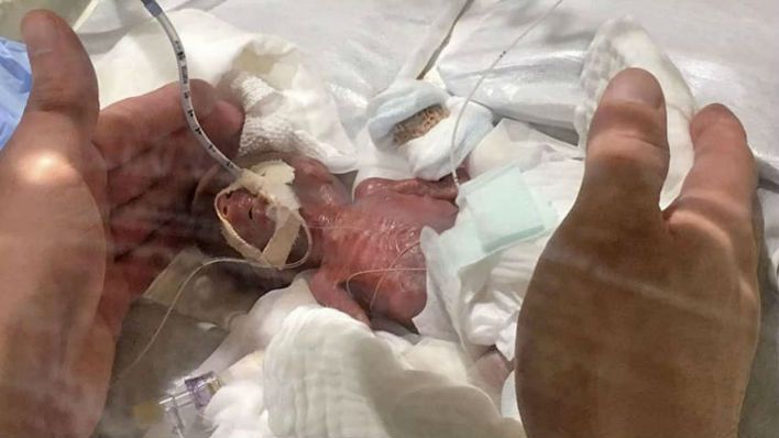 जापान में हुआ सेब के वजन के बराबर का बेबी बॉय, अब अपने घर जाने के लिए है तैयार