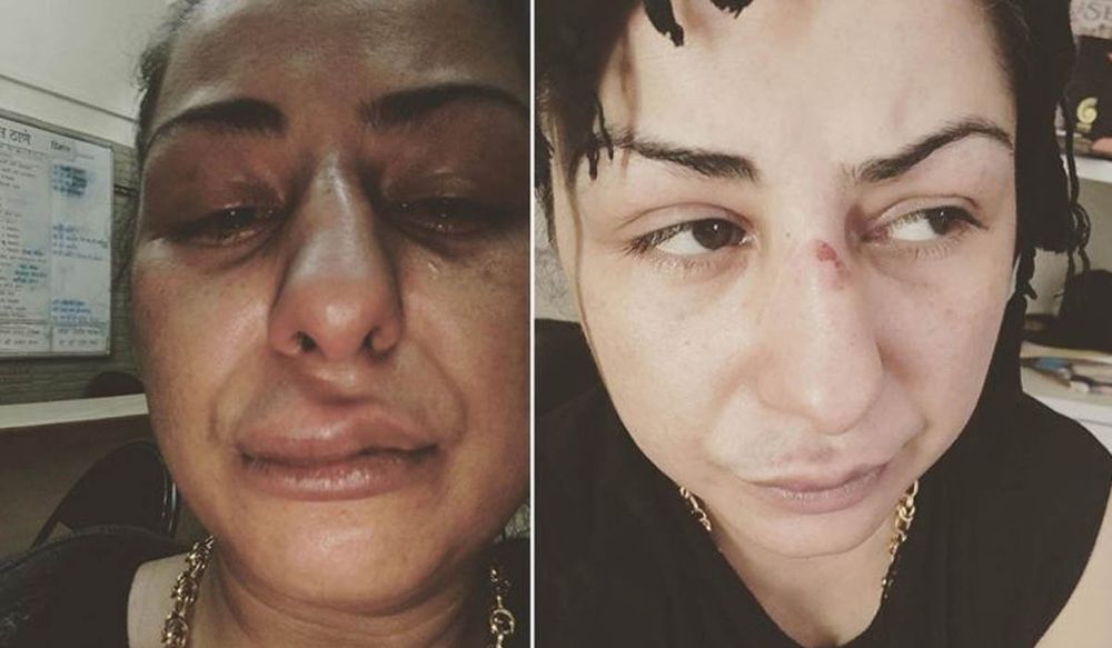 Viral Picture: क्या मोदी और शाह पर अभद्र टिप्पणी के बाद हार्ड कौर की हुई पिटाई?