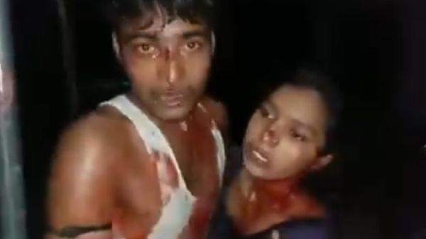 सोशल मीडिया पर खून से लथपथ भाई बहन का वीडियो वायरल, उड़ रही हैं कई अफवाहें, क्या है सच्चाई?