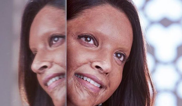 Chhapaak Trailer Review: रिलीज़ हुआ छपाक का ट्रेलर, देखकर आप हो जाएंगे इमोशनल